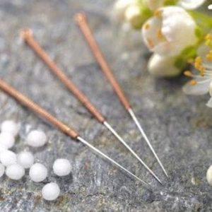 דיקור-סיני-מיכאלה-עפרוני